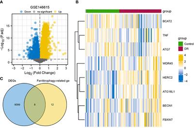 Comprehensive analysis of ferritinophagy-related genes and immune infiltration landscape in diabetic retinopathy